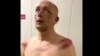 В Пензе возбудили дело из-за давления на задержанного. Его пытали в СИЗО, а позже заставляли отказаться от претензий